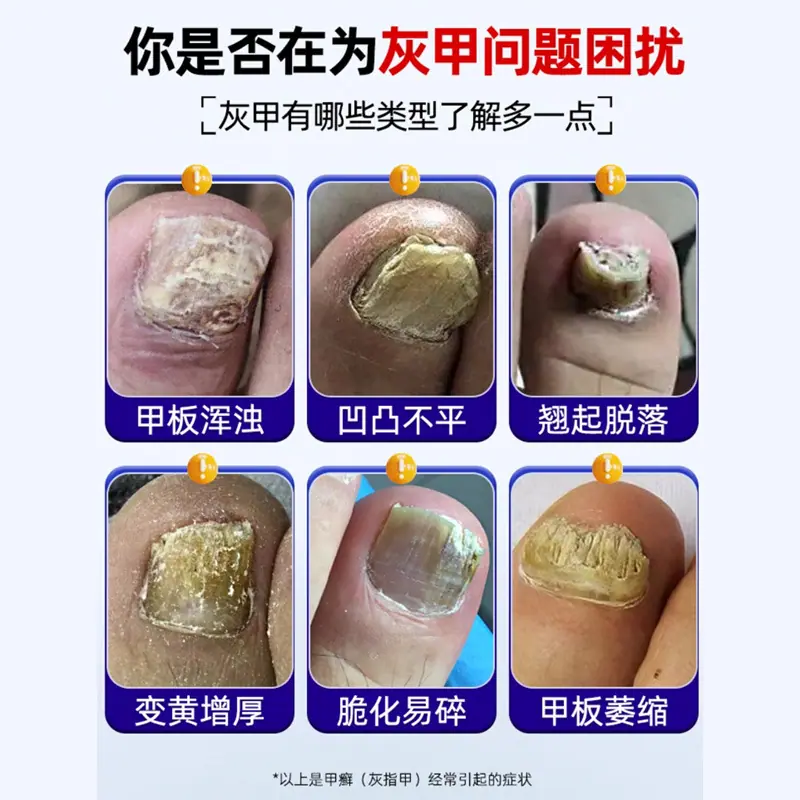 医用足部敷料-3