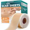 Tiras de Silicona para Eliminación de Cicatrices Transfronterizas Cinta para Cicatrices Parche Invisible Calmante Ocultador para Cicatrices