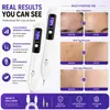 Pluma de Belleza de Plasma LED Recargable por USB 9 Niveles Cuidado de la Piel Disposi