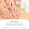 Caneta para Cuidados com as Unhas Ximonth Nutre as Unhas das Mãos e dos Pés, Suaviza a Superfície da Unha e Dá Brilho Caneta para Cuidados Diários com as Unhas