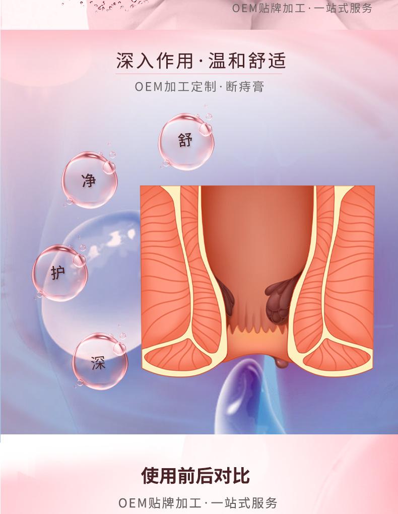 断痣膏详情页_03