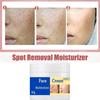 Crema de Belleza para Piel Nueva Transfronteriza 50g Crema para Manchas de Belleza de la Piel Desvanece Melasma Facial Manchas de Quemaduras Solares Iluminación de la Piel Aclaramiento de la Piel