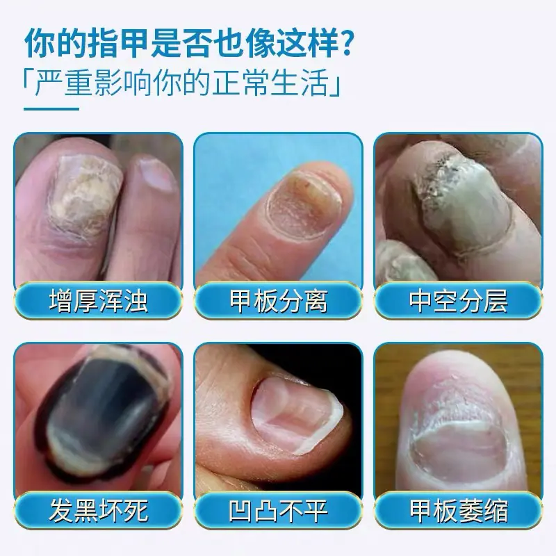 医用足部敷料主图2