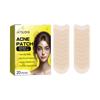 Parche para el acné Jaysuing para limpiar el acné facial, acné cerrado, puntos negros, piel delicada, parche para el acné