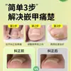 Pegado de uñas sin pegamento, corrección de surcos para uñas, parche para uñas, manicura Lala, productos de fábrica