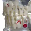 Comércio Exterior Modelo Odontológico Modelo de Ensino Modelo de Patologia Infantil M4002 Exibição Modelo de Dente Decíduo Dental Dentes Decíduos Permanentes