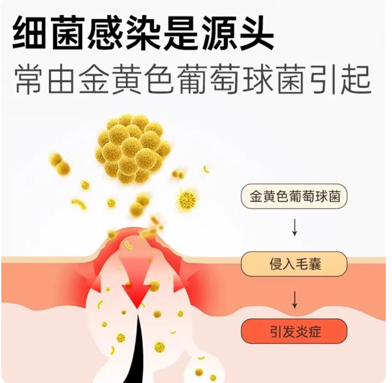 医用足部敷料-4