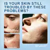 Polvo de ácido hialurónico transfronterizo productos hidratantes para el cuidado de la piel facial Polvo de ácido hialurónico