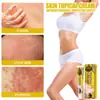 Crema reparadora de piel transfronteriza manchas musgo manchas de sudor ungüento tópico crema para picazón de piel venta al por mayor