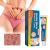 Crema Smmlpun para Verrugas y Lunares en Zonas Íntimas