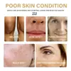Superventas Transfronterizo Eelhoe Esencia Correctora de Cúrcuma Cuidado Facial Hidratante y Humectante Nutrición Suave para la Piel