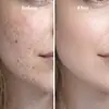 Esencia de Péptido de Cobre Ghk Transfronteriza 30ml Empaque Neutro