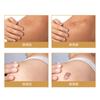Rollo de Gel de Silicona Piel Cicatriz Autoadhesivo Cubriente Pegatina Tatuaje Hoyuelo Hoyuelo Hoyuelo Transpirable Impermeable Recortable Bolsita Correctora