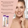 Crema de ácido azelaico: Cuidado refrescante y suave para piel propensa al acné, cuidado facial diario, piel elástica, crema facial limpiadora e hidratante, portátil