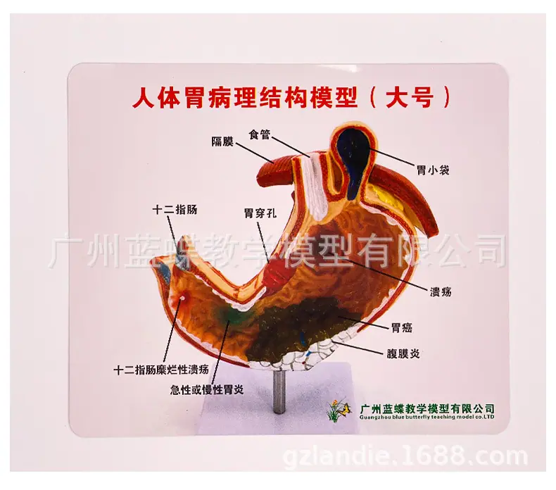 详情_17