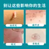 Xianhuaitang Yaqidan Líquido Antibacteriano para Verrugas, Callos, Durezas y Eliminación de Lunares para Uso Externo - Fabricante de Origen