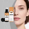 Aceite Esencial Roll-On para Ojos Hoygi de Ricino Cuidado Suave para la Piel Alrededor de los Ojos, Hidratante, Suave y Delicada, Cuidado Diario