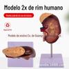 Modelo de aumento de rim 2X, versão ampliada, modelo de anatomia renal, 1 peça, modelo de anatomia visceral humana