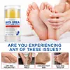 Stick para el Cuidado de Pies Ikzee Urea Transfronterizo Hidratante e Hidratante Pies Agrietados Anti-Sequedad Agrietamiento Crema Exfoliante para el Cuidado 40g