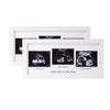 Marco de Fotos Triple de Madera Transfronterizo para Fotos de Ultrasonido del Embarazo, Enmarcado como Regalo para Conmemorar el Nacimiento de la Madre y el Bebé