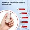 Tk Popular Cruzamento de Fronteiras Bastão de Silicone para Cicatriz Hidrata e Suaviza a Pele do Rosto, Bastão de Silicone Suave para Cicatriz