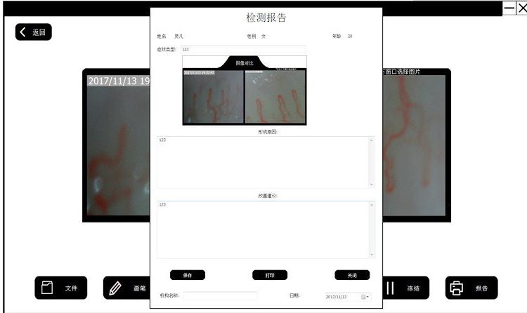保存图片，点击软件中的报告