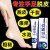 Yuanfang Nixi 15g Manos y Pies Secos y Descamados Crema Tópica Hidratante para la Piel Crema Antibacteriana Herbal para Descamación de Manos y Pies