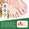 Sumifun Amazon Aliexpress Temu Exportación Transfronteriza Rusa Comercio Electrónico Crema para el Cuidado de la Onicomicosis Crema Esmalte de Uñas