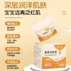 Creme Hidratante com Gema de Ovo, Pomada de Gema de Ovo, Creme para Assaduras, Melhora a Pele Seca, Creme para Assaduras com Óleo de Gema de Ovo, Atacado e Dropshipping