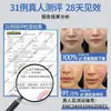 Banda de Venda para Cara en V para Levantar y Tensar el Rostro, Reducir Surcos Nasogenianos, Flacidez, Mascarilla de Escultura Facial, Herramienta de Lifting Facial Completo, Reducción de Papada