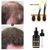Aceite Esencial de Romero y Aceite de Ricino para el Cuidado del Cabello de Venta Caliente Transfronteriza, Serum de Aceite de Ricino Nutritivo para el Cuero Cabelludo y Espesante del Cabello