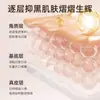 Creme de Arbutin de Su Xiuchen Hidratante e Umectante Melhora a Secura Niacinamida Clareia a Pele Delicada Creme Hidratante