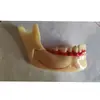 Modelo de Disección de Tejido Óseo Mandibular Modelo de Entrenamiento para el Cuidado Bucal Modelo de Entrenamiento de Tejido Óseo Mandibular