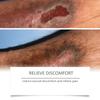 Caneta de Cuidados com a Pele Vorvita Melhora Suavemente a Limpeza da Pele do Corpo Pressionar em Xadrez Portátil Caneta de Cuidados Domésticos