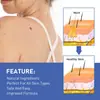 Crema Removedora de Verrugas South Moon para Piel del Cuerpo, Elimina Verrugas, Lunares Negros, Acrocordones y Callos, Limpia y Suaviza la Piel Suavemente