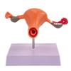 Modelo de útero femenino médico modelo de estructura reproductiva ovárica modelo de anatomía ginecológica Obstetricia y Ginecología modelo de ovario y útero