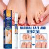 Lápiz reparador de uñas transfronterizo ERAYCEE, solución para el cuidado de las uñas con onicomicosis, limpieza y engrosamiento, lápiz reparador para onicomicosis.