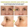 Ouhoe Barra de Crema para Ojos Cuidado de Caracol Antiarrugas Aclara Ojeras Líneas Finas Hidratante Ojos Crema para Ojos Antiarrugas Reafirmante