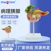 Modelo de Simulação de Ensino de Pâncreas, Baço, Fígado, Vesícula Biliar e Duodeno Doentes; Espécime de Pâncreas Patológico; Anatomia do Pâncreas, Baço, Fígado e Vesícula Biliar
