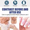 Crema Reparadora de Uñas para Onicomicosis Transfronteriza Mano Pie Uña Reparación Onicomicosis Iluminación Cuidado de Uñas Crema Venta al por Mayor