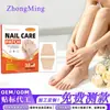 Parchezhongming Amazon Transfronterizo para el Cuidado de las Uñas para Onicomicosis y Uñas Encarnadas, Parche Corrector, Comercio Exterior En Stock Mayorista 1