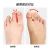 Manga de Silicona para Corrección de Pulgar de Pies con Doble Orificio Separador de Dedos Pulgar Dedos Superpuestos Ortesis para Pies al por Mayor