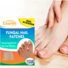 Crazylife patch transfronteiriço para cuidados com as unhas incrustação sulco da unha carne embutida patch ortopédico unha macia unha cinza patch de reparo de unha