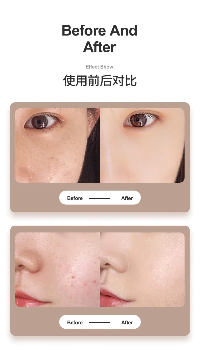 点痣笔详情页_05