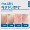 Loção Reparadora Médica para Barreira Cutânea Danificada e Vermelhidão, Creme Facial Multiuso, Hidratante e Umectante, Marca de Dispositivo Médico