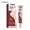 Zourunan Área das Veias Zhang Pomada Dor nas Veias Perna de Aranha Cuidados com a Saúde Creme Herbal Aliviar Dor nas Pernas Suavizante
