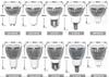 Lámpara de 5W Vaso MR16/GU10/GU5.3/E27E14 aluminio para coche alta potencia foco LED carcasa lámpara LED Vaso anidado
