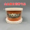 Modelo ortodôntico dental modelo autoligante de cermet oral display de comunicação médico-paciente ambulatorial modelo dental de ensino