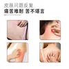 Alívio de Alergia para Coceira e Inchaço na Pele Roll-On Creme de Massagem Oem Feito Sob Medida Pomada Calmante para Alergias de Pele, Vermelhidão e Manchas com Coceira