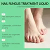 Solución para el cuidado de uñas Suchodam Nutre Suavemente la Superficie de la Uña, la Hace Brillante, Suave, Limpia y Cuida la Solución para Uñas de Manos y Pies